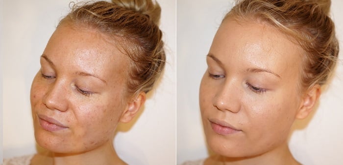 milani conceal perfect foundation before after