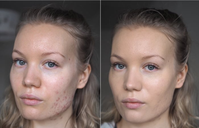 before after clarins everlasting foundation