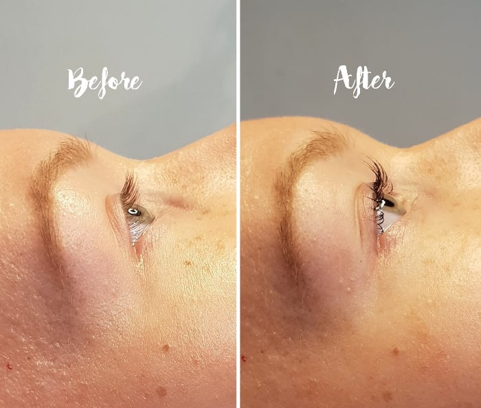 yumi lash lift before after