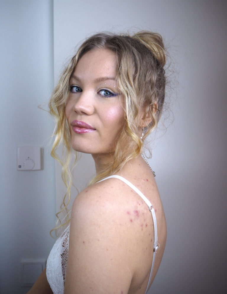 Red light therapy for hormonal acne & other skin issues Charlotta Eve