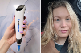 microneedling with dermapen review